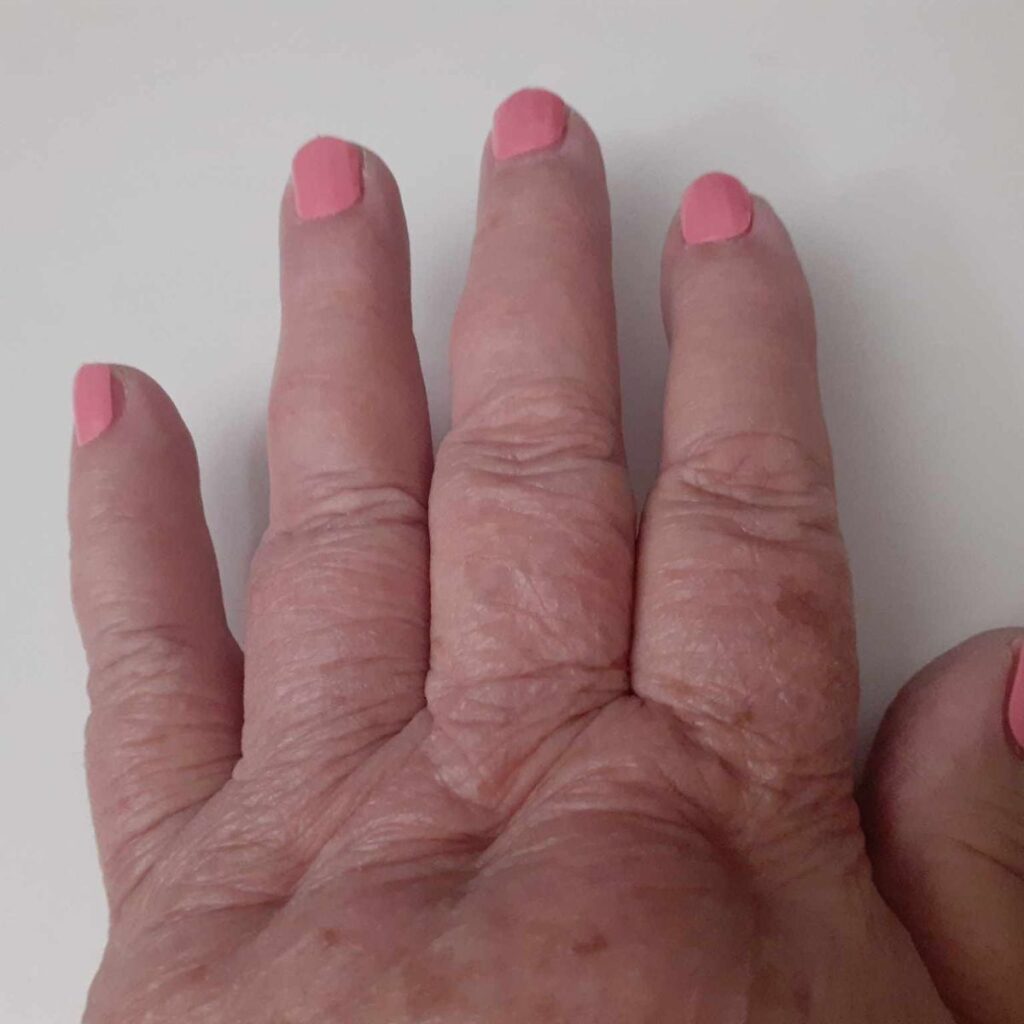 Image #1 from Judy C.