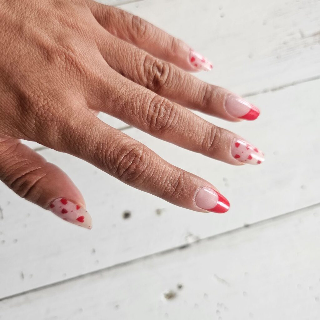 Image #1 from Anonymous