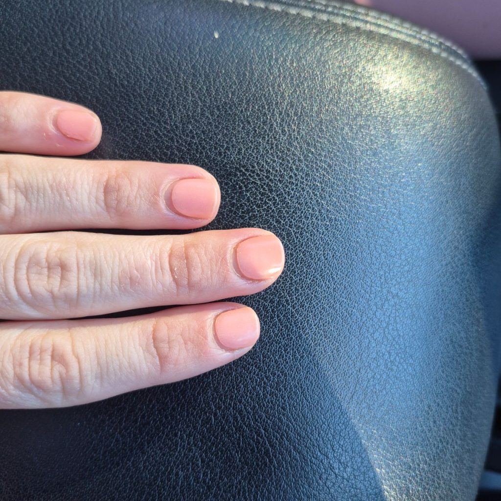 Image #1 from Renae Simpson