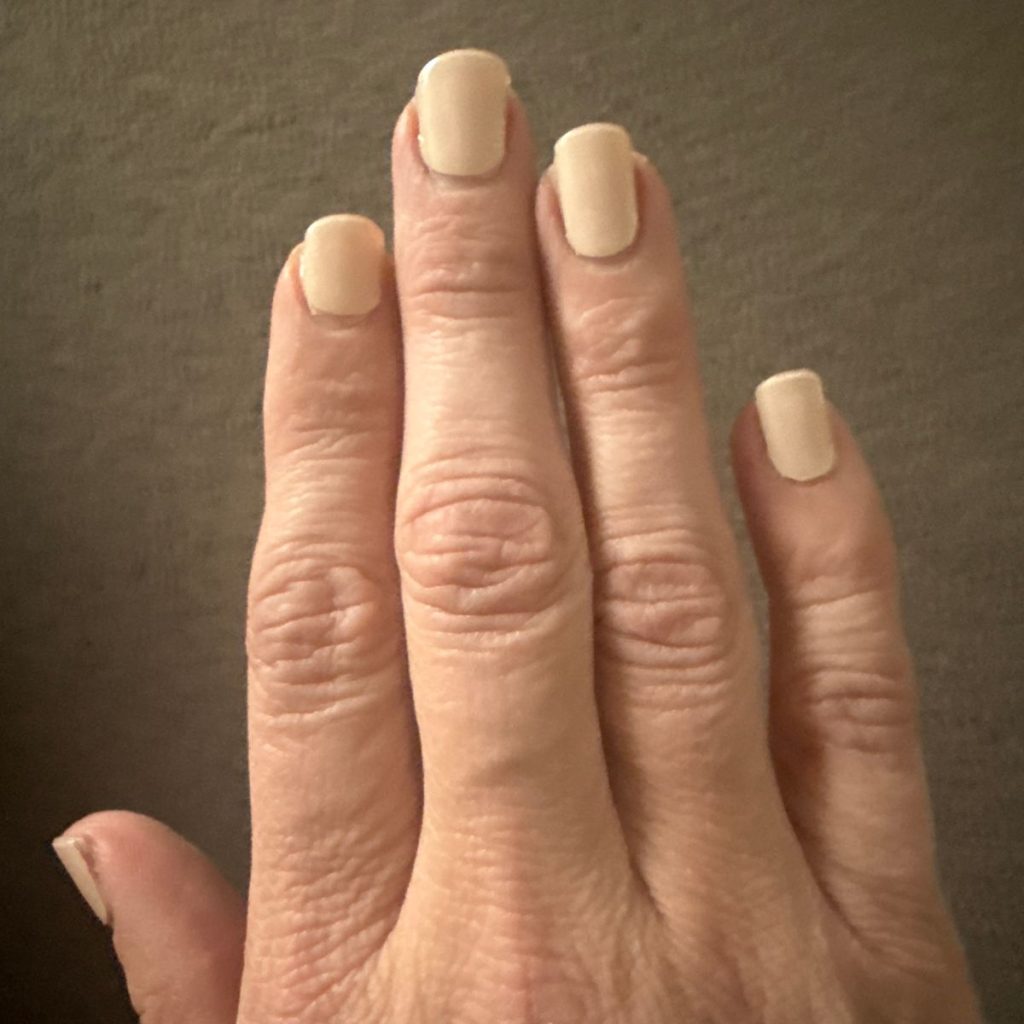 Image #1 from Anonymous